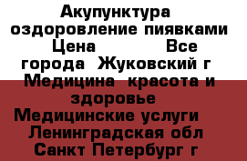 Акупунктура, оздоровление пиявками › Цена ­ 3 000 - Все города, Жуковский г. Медицина, красота и здоровье » Медицинские услуги   . Ленинградская обл.,Санкт-Петербург г.